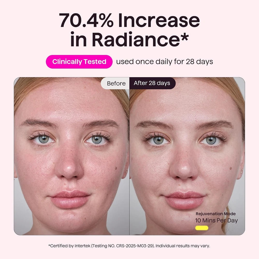 wavytalk LED Light Therapy Face Mask